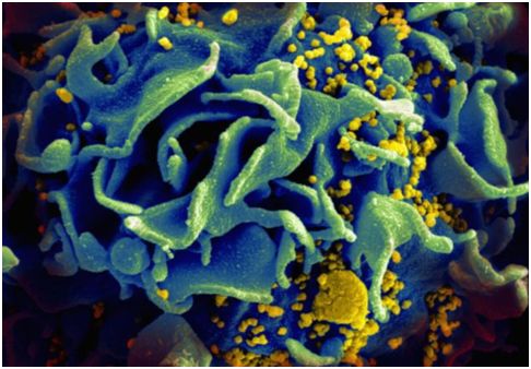 日本逼网开发出靶向HIV病毒库的Dual-CAR-T细胞,为治愈HIV感染奠定基础